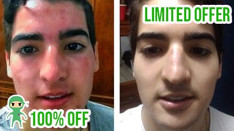 Free Coupon Acne: Effective Solution from the Root