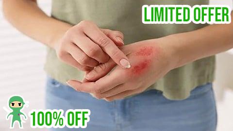 Free Coupon Beyond the Burn: Comprehensive Burn Care Strategies